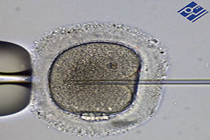 embryo monitoring 1 ICSI
